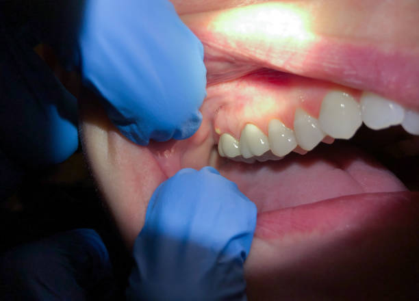 Best Emergency Cosmetic Dentistry in Inglewood, CA